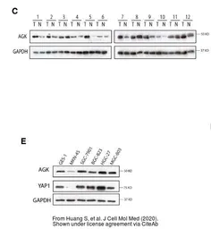Anti-GAPDH antibody [GT239] used in Western Blot (WB). GTX627408