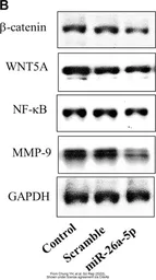 Anti-GAPDH antibody [GT239] used in Western Blot (WB). GTX627408