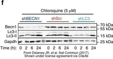 Anti-GAPDH antibody [GT239] used in Western Blot (WB). GTX627408