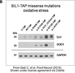 Anti-GAPDH antibody [GT239] used in Western Blot (WB). GTX627408