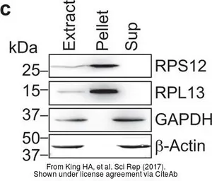 Anti-GAPDH antibody [GT239] used in Western Blot (WB). GTX627408