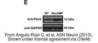 Anti-GAPDH antibody [GT239] used in Western Blot (WB). GTX627408