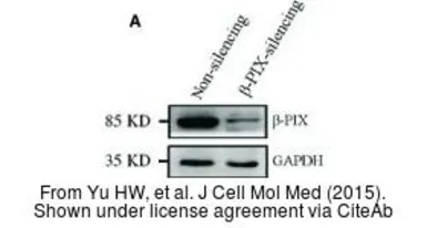 Anti-GAPDH antibody [GT239] used in Western Blot (WB). GTX627408