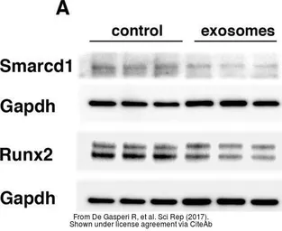 Anti-GAPDH antibody [GT239] used in Western Blot (WB). GTX627408