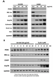 Anti-GAPDH antibody [GT239] used in Western Blot (WB). GTX627408