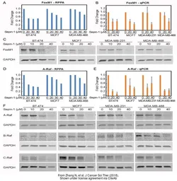 Anti-GAPDH antibody [GT239] used in Western Blot (WB). GTX627408