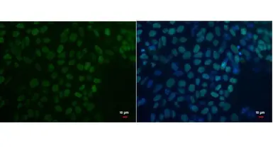 Anti-Oct4 antibody [GT486] used in Immunocytochemistry/ Immunofluorescence (ICC/IF). GTX627419