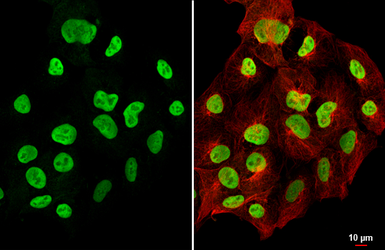 Anti-Oct4 antibody [GT486] used in Immunocytochemistry/ Immunofluorescence (ICC/IF). GTX627419