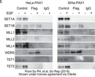 Anti-TET1 antibody [GT1462] used in Western Blot (WB). GTX627420