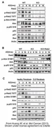 Anti-Nanog antibody [GT3312] used in Western Blot (WB). GTX627421