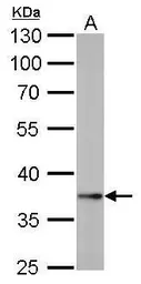 Anti-Nanog antibody [GT3312] used in Western Blot (WB). GTX627421