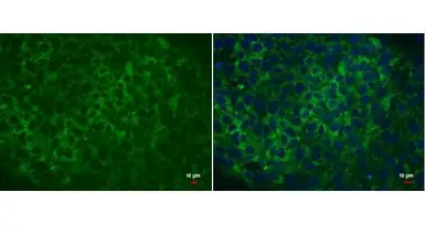 Anti-Lin28A antibody [GT717] used in Immunocytochemistry/ Immunofluorescence (ICC/IF). GTX628138