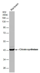 Anti-Citrate synthase antibody [GT1761] used in Western Blot (WB). GTX628143