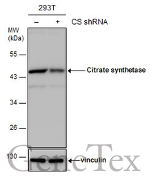 Anti-Citrate synthase antibody [GT1761] used in Western Blot (WB). GTX628143