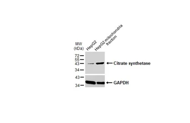 Anti-Citrate synthase antibody [GT1761] used in Western Blot (WB). GTX628143