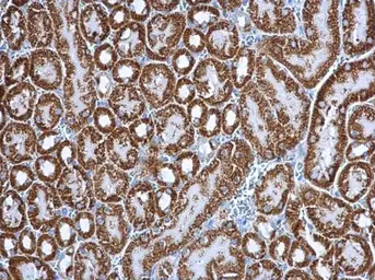 Anti-Citrate synthase antibody [GT1761] used in IHC (Paraffin sections) (IHC-P). GTX628143