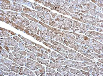 Anti-Citrate synthase antibody [GT1761] used in IHC (Paraffin sections) (IHC-P). GTX628143