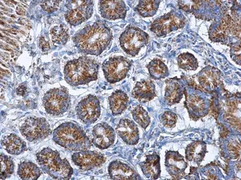 Anti-Citrate synthase antibody [GT1761] used in IHC (Paraffin sections) (IHC-P). GTX628143