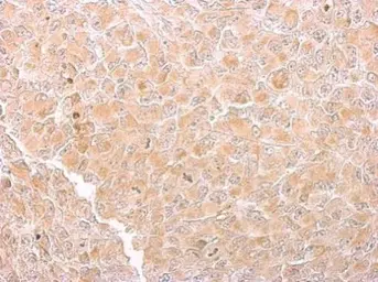 Anti-Citrate synthase antibody [GT1761] used in IHC (Paraffin sections) (IHC-P). GTX628143