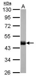 Anti-Citrate synthase antibody [GT1761] used in Western Blot (WB). GTX628143