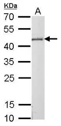 Anti-Citrate synthase antibody [GT2061] used in Western Blot (WB). GTX628144