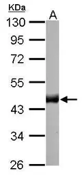 Anti-Citrate synthase antibody [GT2061] used in Western Blot (WB). GTX628144