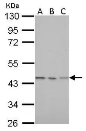 Anti-Citrate synthase antibody [GT2061] used in Western Blot (WB). GTX628144