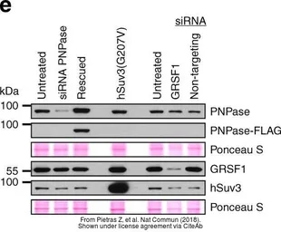 Anti-SUPV3L1 antibody [GT244] used in Western Blot (WB). GTX628260