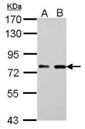 Anti-SUPV3L1 antibody [GT244] used in Western Blot (WB). GTX628260