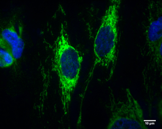 Anti-IDH2 antibody [GT673] used in Immunocytochemistry/ Immunofluorescence (ICC/IF). GTX628487