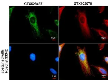 Anti-IDH2 antibody [GT673] used in Immunocytochemistry/ Immunofluorescence (ICC/IF). GTX628487