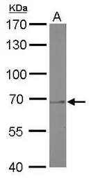 Anti-PRMT5 antibody [GT3610] used in Western Blot (WB). GTX628488
