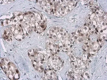 Anti-Cyclin B1 antibody [GT238] used in IHC (Paraffin sections) (IHC-P). GTX628546