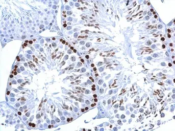 Anti-Histone H2A.XS139ph (phospho Ser139) antibody [GT2311] used in IHC (Paraffin sections) (IHC-P). GTX628789