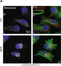 Anti-alpha Tubulin antibody [GT114] used in Immunocytochemistry/ Immunofluorescence (ICC/IF). GTX628802
