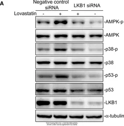 Anti-alpha Tubulin antibody [GT114] used in Western Blot (WB). GTX628802