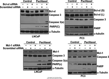 Anti-alpha Tubulin antibody [GT114] used in Western Blot (WB). GTX628802