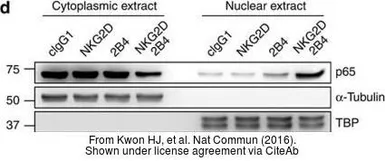 Anti-alpha Tubulin antibody [GT114] used in Western Blot (WB). GTX628802