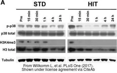 Anti-alpha Tubulin antibody [GT114] used in Western Blot (WB). GTX628802