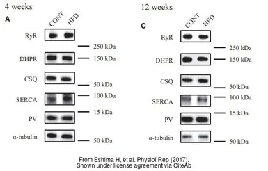 Anti-alpha Tubulin antibody [GT114] used in Western Blot (WB). GTX628802
