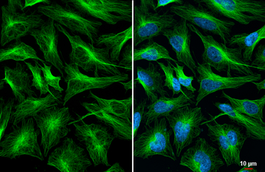 Anti-alpha Tubulin antibody [GT114] used in Immunocytochemistry/ Immunofluorescence (ICC/IF). GTX628802