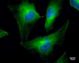 Anti-Cofilin 1 antibody [GT567] used in Immunocytochemistry/ Immunofluorescence (ICC/IF). GTX628804