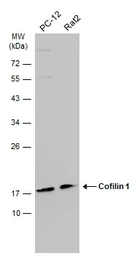 Anti-Cofilin 1 antibody [GT567] used in Western Blot (WB). GTX628804