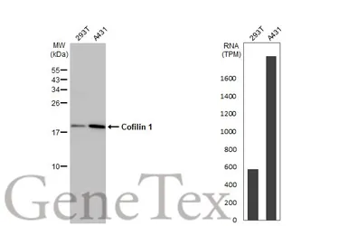 Anti-Cofilin 1 antibody [GT567] used in Western Blot (WB). GTX628804