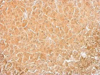 Anti-Cofilin 1 antibody [GT567] used in IHC (Paraffin sections) (IHC-P). GTX628804