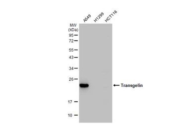 Anti-Transgelin antibody [GT336] used in Western Blot (WB). GTX628831