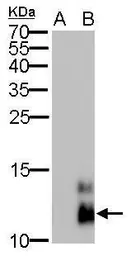 Anti-Pancreatic Polypeptide antibody [GT6512] used in Western Blot (WB). GTX628832