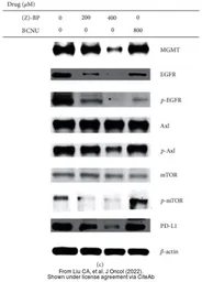 Anti-EGFR antibody [GT133] used in Western Blot (WB). GTX628887