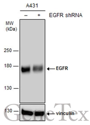 Anti-EGFR antibody [GT133] used in Western Blot (WB). GTX628887