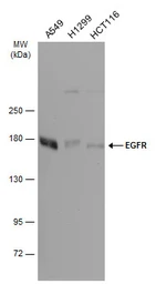 Anti-EGFR antibody [GT133] used in Western Blot (WB). GTX628887